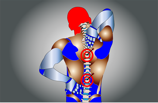 a diagram showing back pain and affected regions